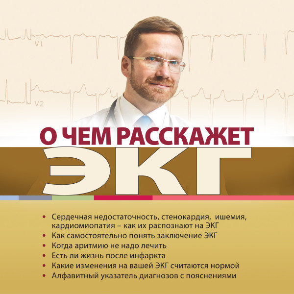 О чем расскажет ЭКГ - Родионов Антон - Аудиокниги слушать онлайн бесплатно без регистрации | электронная библиотека knigi-audio.info